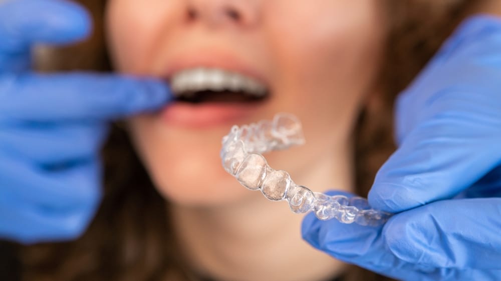 A gloved dentist places an Invisalign tray into a patient's mouth