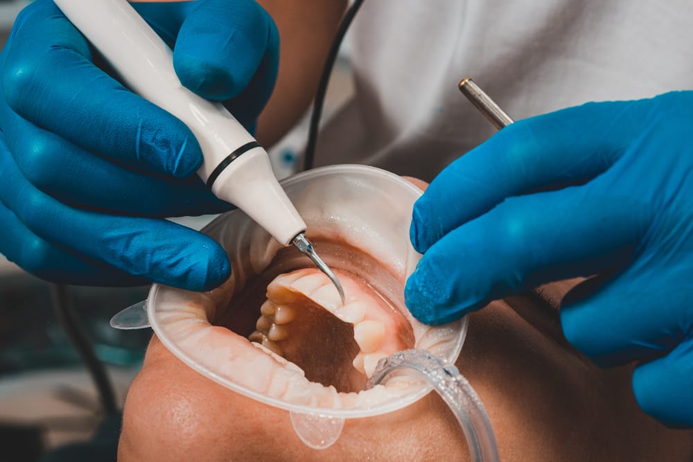 A hygienist uses an ultrasonic scaler on a patient during a dental cleaning
