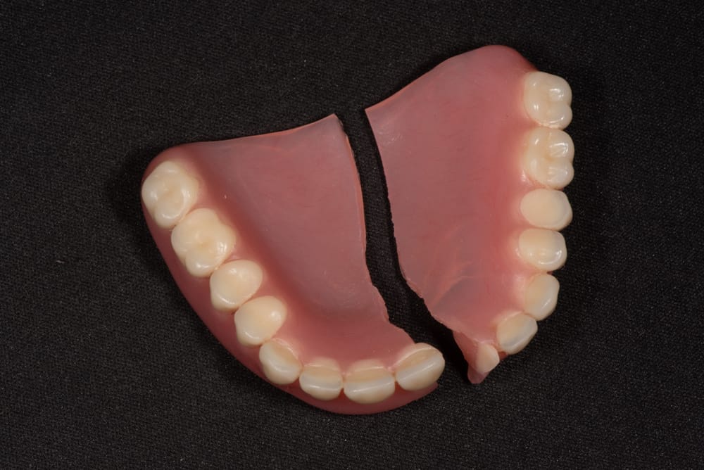 Broken Acrylic Traditional Denture